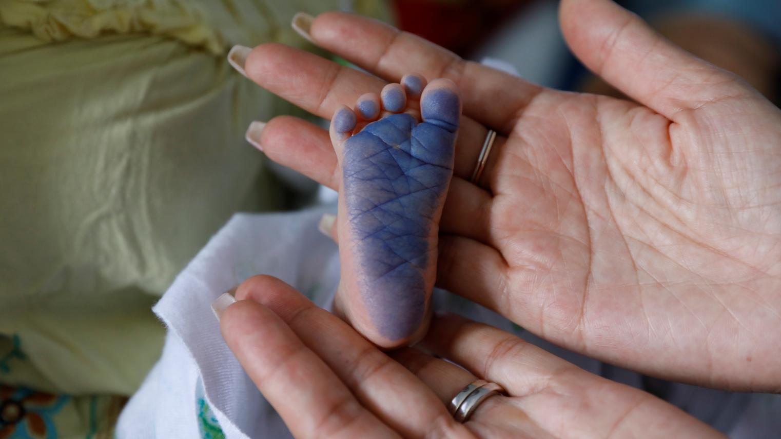 An ink marking is applied to the sole of a Burmese migrant infant’s foot for identification at Mae Tao Clinic in Mae Sot, Thailand. Credit: Shakeel.